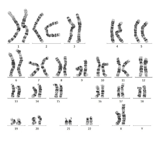 GMP级Laminin 521支持Pre-coating方法的iPSC扩增