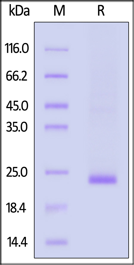 SDS-PAGE验证