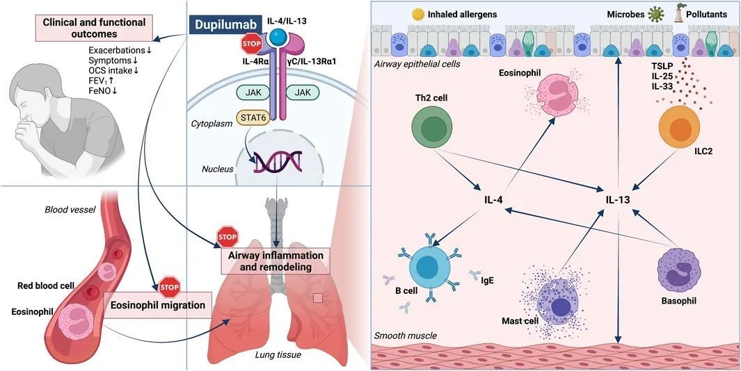 IL-4/IL-13在Th2哮喘的病理生理学和生物治疗中的作用机制