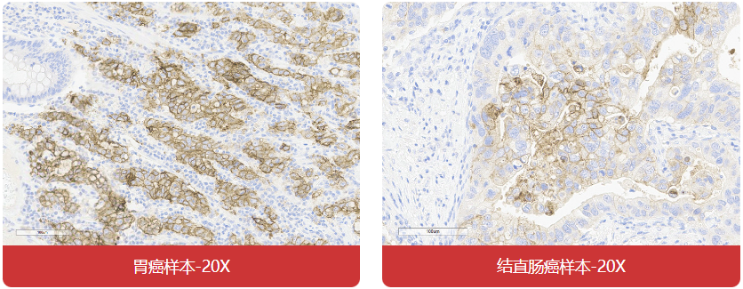 免疫组化（IHC）抗体