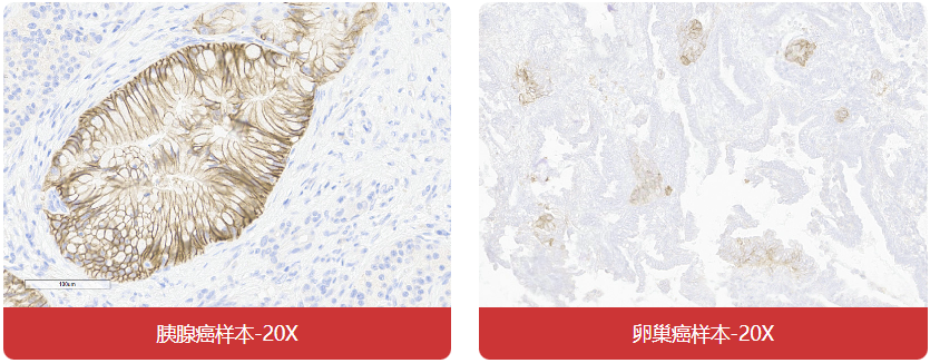 免疫组化（IHC）抗体