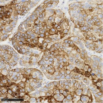 免疫组化（IHC）抗体试用装