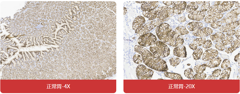 免疫组化（IHC）抗体试用装