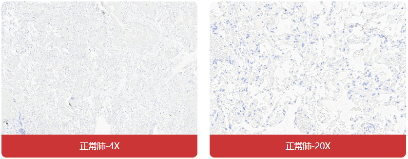 免疫组化（IHC）抗体试用装