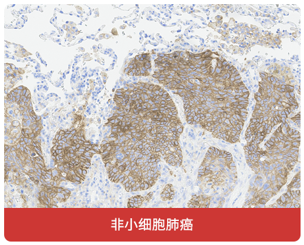 免疫组化（IHC）抗体试用装