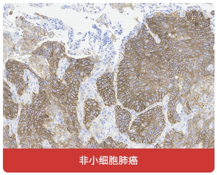 免疫组化（IHC）抗体试用装