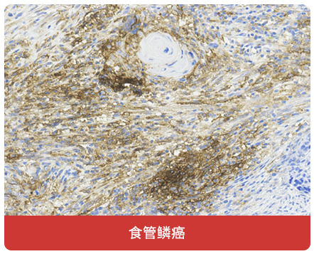 免疫组化（IHC）抗体试用装