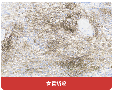 免疫组化（IHC）抗体试用装