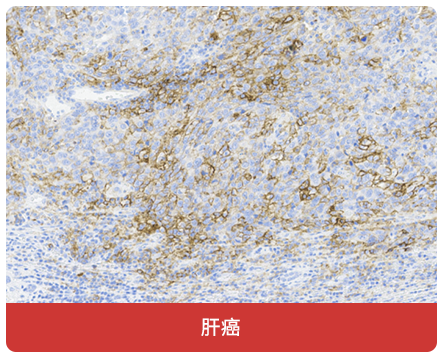 免疫组化（IHC）抗体试用装