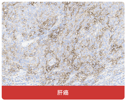 免疫组化（IHC）抗体试用装