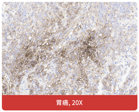 免疫组化（IHC）抗体试用装