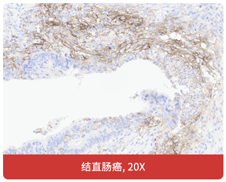 免疫组化（IHC）抗体试用装