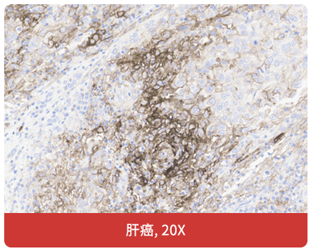 免疫组化（IHC）抗体试用装