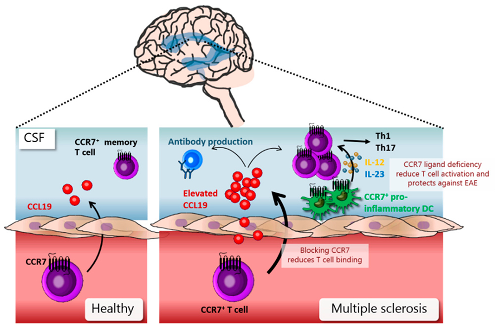 CCR7与多发性硬化症