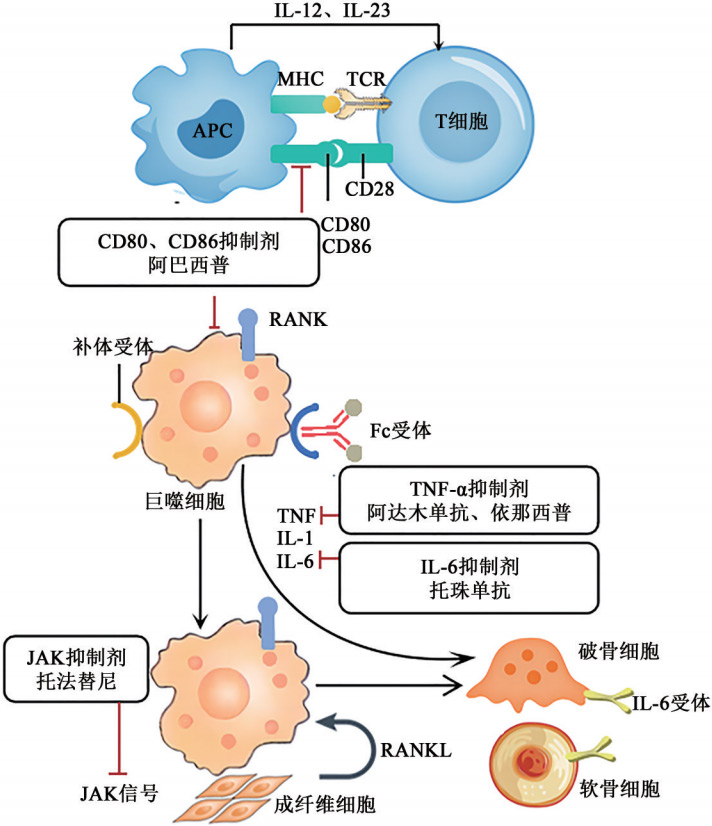 类风湿性关节炎药物开发与治疗