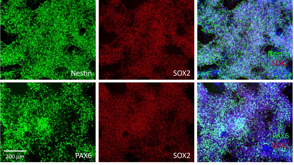 Aneuro联合Organoid Toolbox助您解码帕金森病新前沿