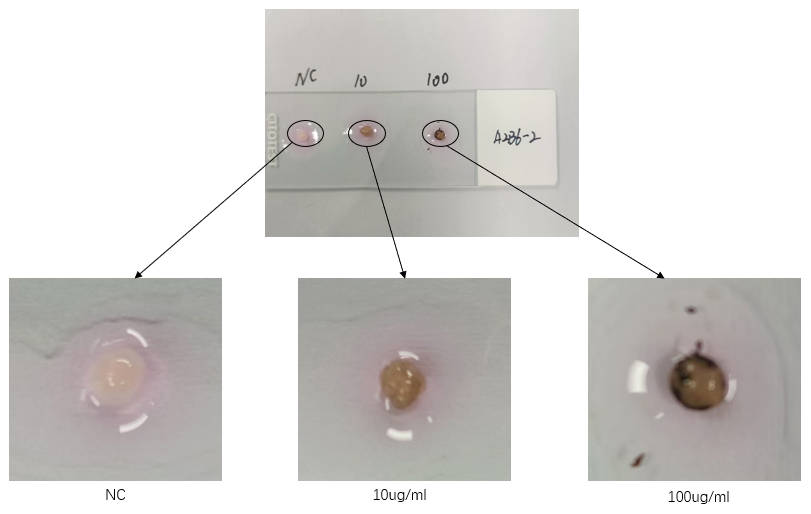 Aneuro联合Organoid Toolbox助您解码帕金森病新前沿