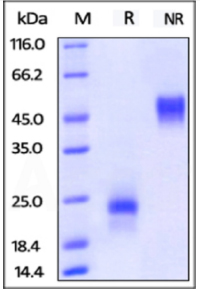SDS-PAGE